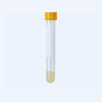 Gold-Top Serum Separator Tubes